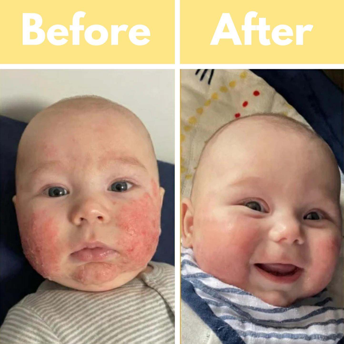 CliniBee Honey & Oatmeal Eczema Cream