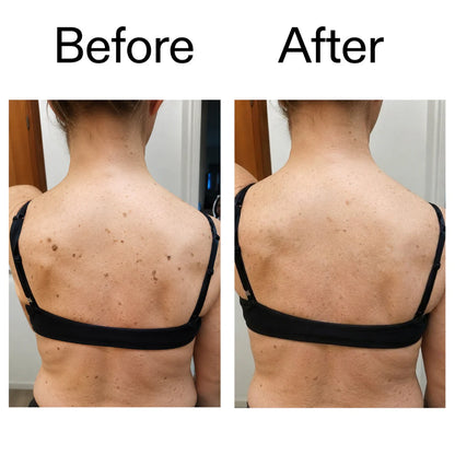 Glycolic Body Stick